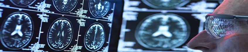 神經(jīng)干細胞移植的過(guò)程