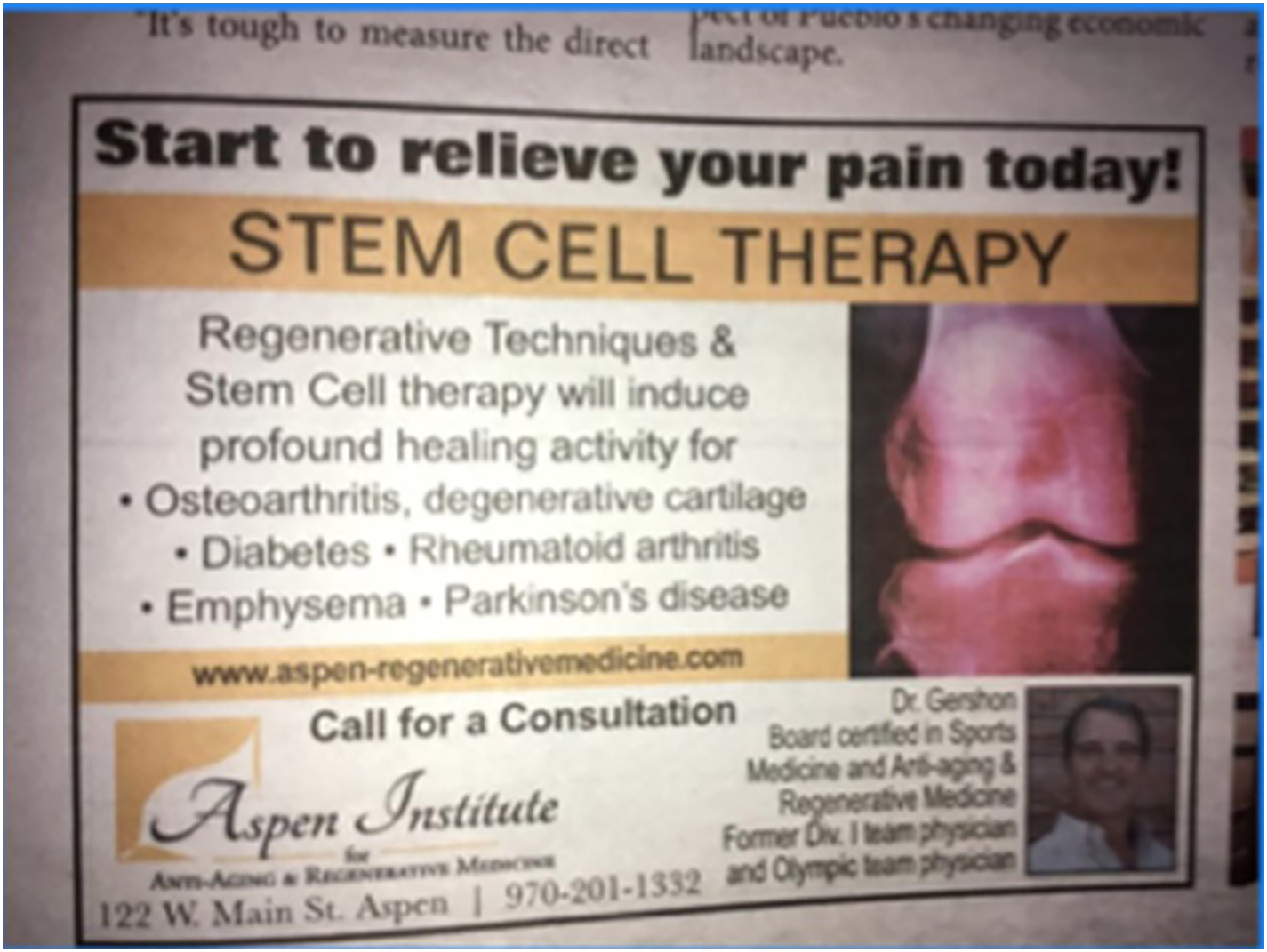 間充質(zhì)干細胞治療1型糖尿病臨床應用案例