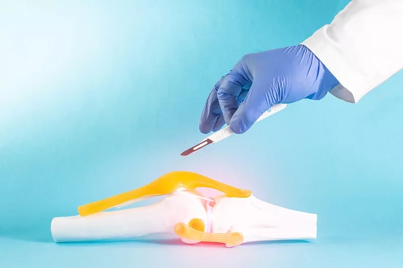 間充質(zhì)干細胞在人類(lèi)半月板修復中的潛在用途:當前見(jiàn)解