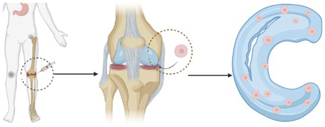 圖1：干細胞注射方法的過(guò)程示意圖。