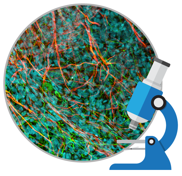 干細胞治療如何對自閉癥患者提供幫助？