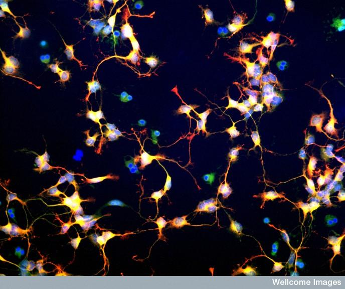 中科神經(jīng)干細胞