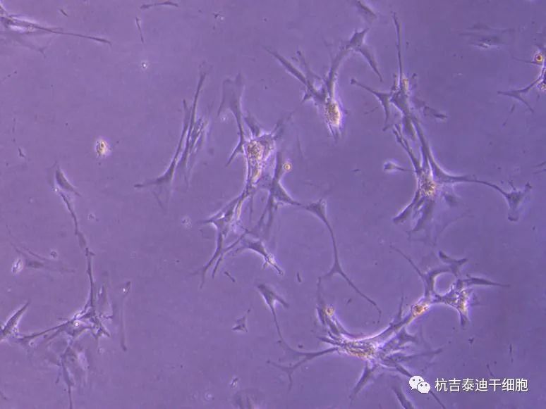 可能的腎臟干細胞，在實(shí)驗室中生長(cháng)