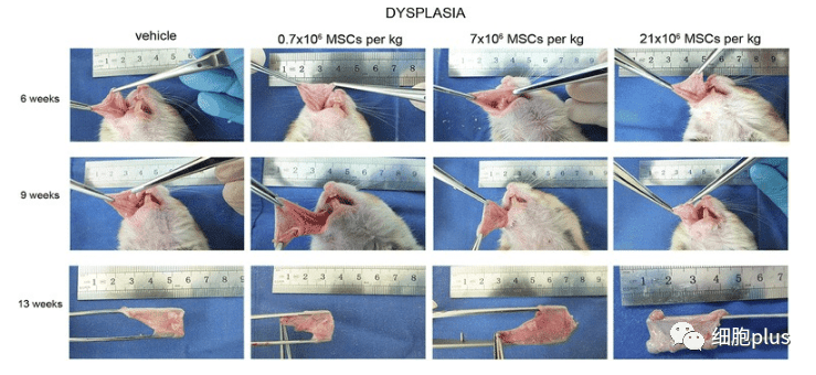 在腫瘤增生期，全身注射同種異體間充質(zhì)干細胞不會(huì )加速癌前病變的進(jìn)展。