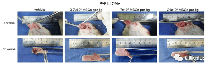 在非典型增生期，全身注射同種異體間充質(zhì)干細胞不會(huì )加速癌前病變的進(jìn)展。