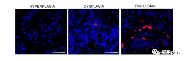 4?全身注射同種異體間充質(zhì)干細胞很少進(jìn)入癌前病變