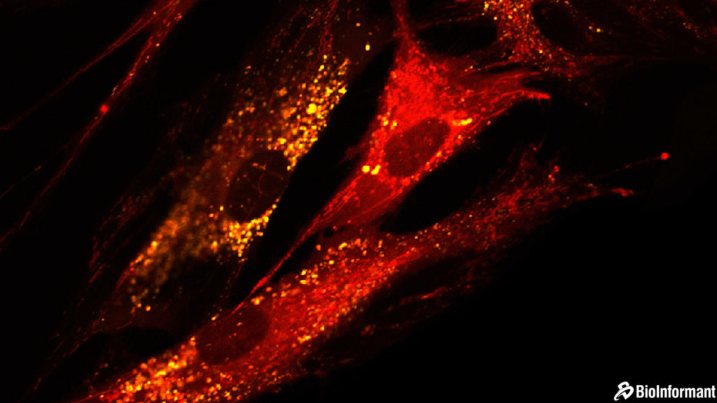 干細胞的好處|  間充質(zhì)干細胞 (MSC) 相對于其他干細胞類(lèi)型的優(yōu)勢