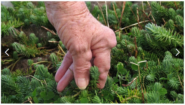 類(lèi)風(fēng)濕關(guān)節炎癥狀