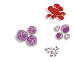 用于移植的干細胞可以來(lái)自骨髓或血液