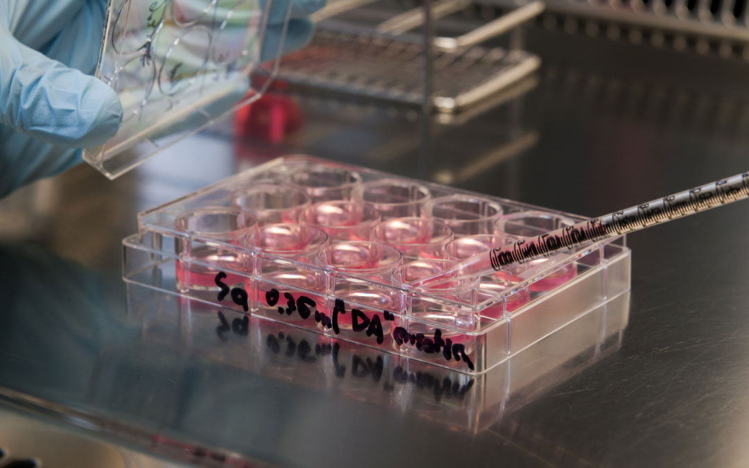 踝關(guān)節疼痛的干細胞療法 踝關(guān)節疼痛的干細胞療法