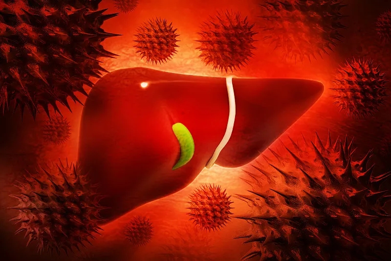 慢性肝病 (CLD) – 原因、癥狀、可用的治療方法