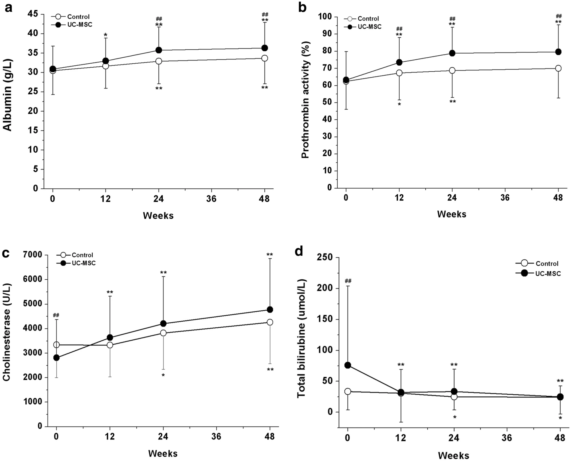 臍帶間充質(zhì)干細胞治療對失代償期肝硬化患者肝功能的影響