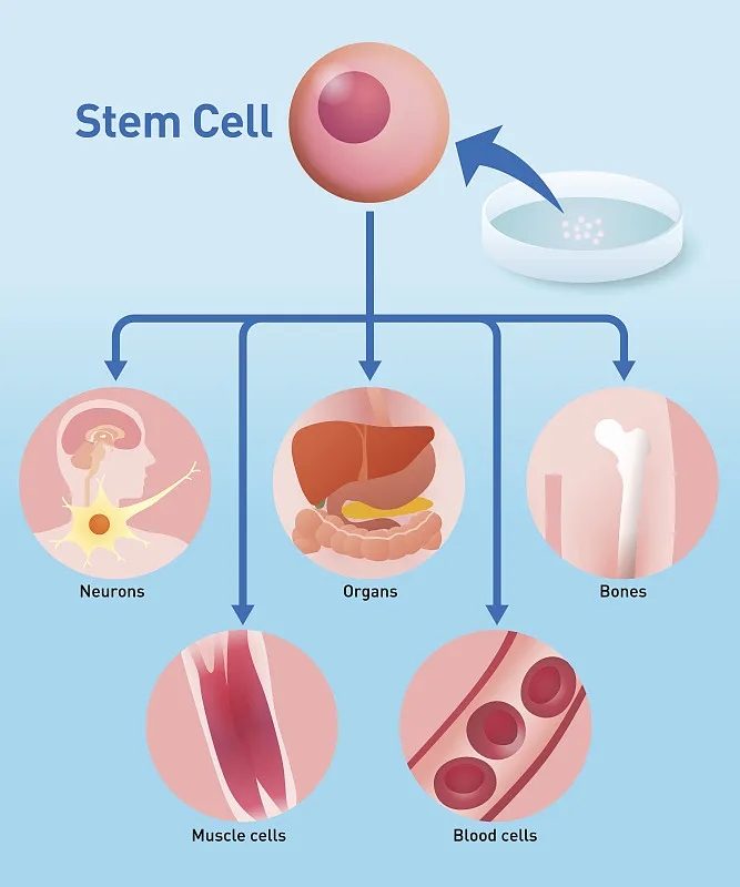 自體干細胞移植：工作原理、益處和風(fēng)險