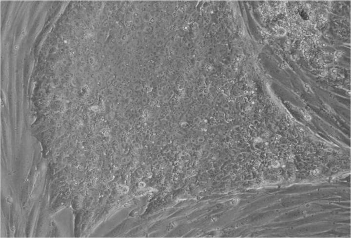 胚胎干細胞移植的來(lái)源 胚胎干細胞移植的來(lái)源