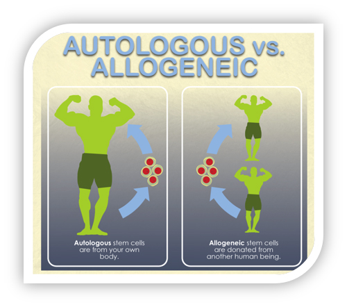 自體與同種異體干細胞 自體與同種異體干細胞