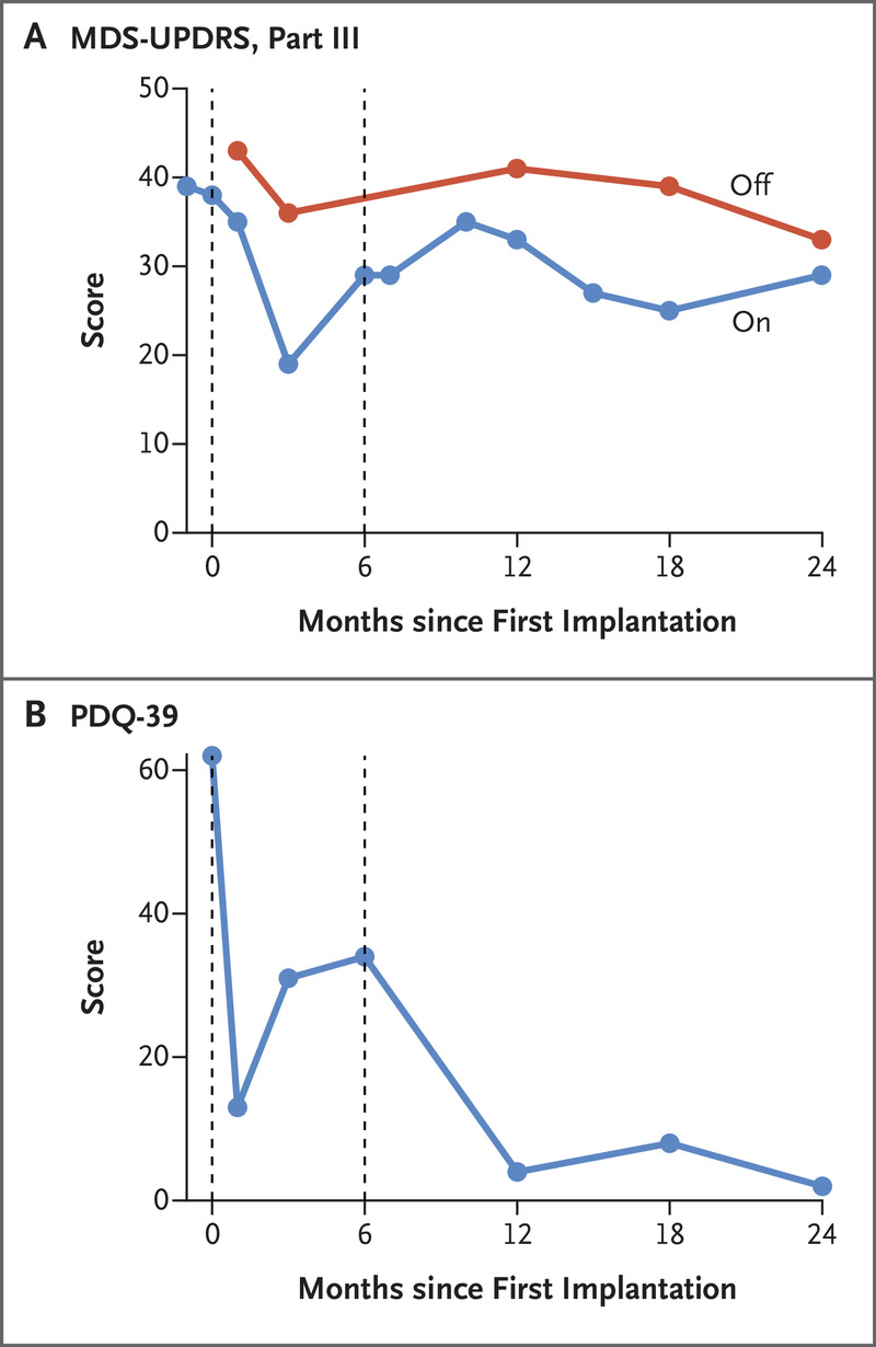 圖3.帕金森病相關(guān)運動(dòng)能力和生活質(zhì)量的橫向臨床評估。