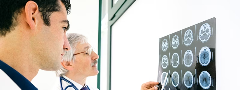 中風(fēng)期間會(huì )發(fā)生什么？癥狀、后果和治療方案是什么？