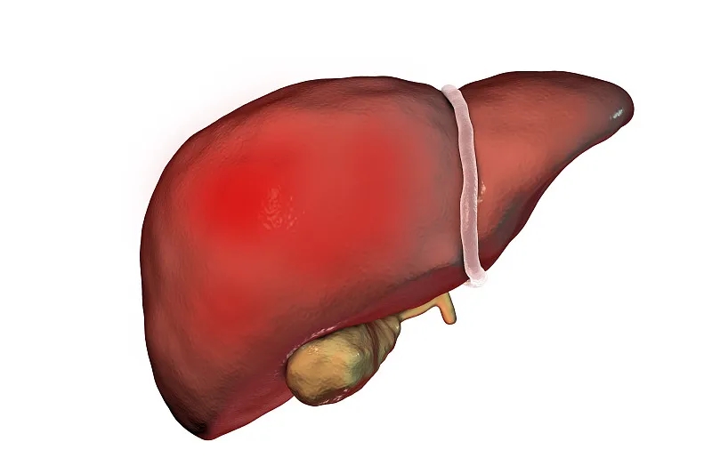 什么是丁型肝炎？