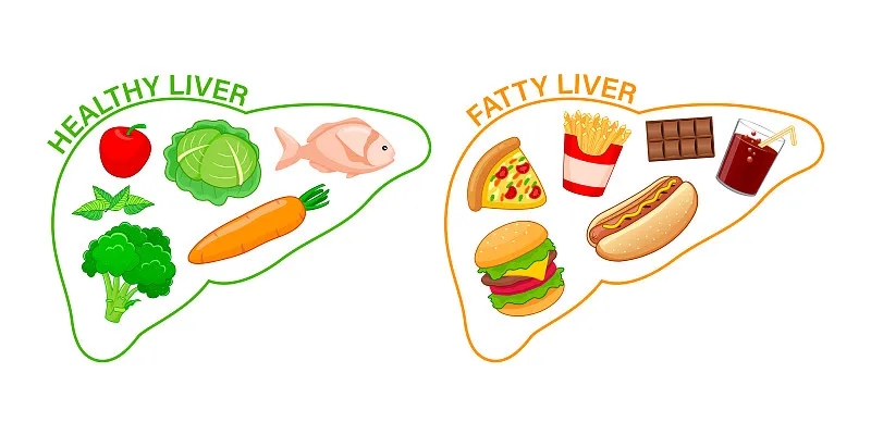 如何才能讓我的肝臟恢復健康？