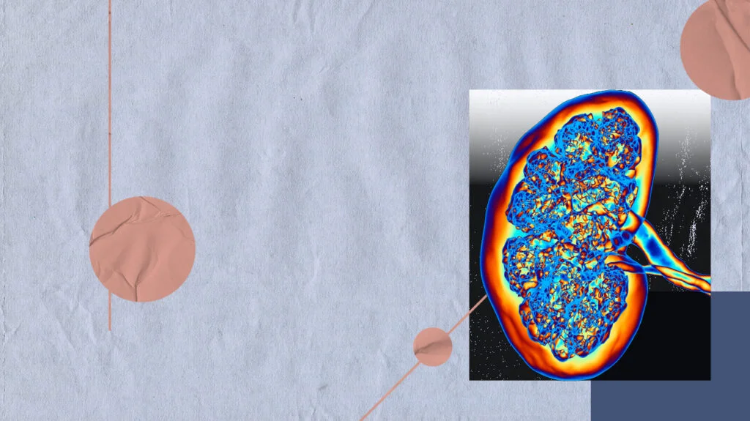 急性腎損傷與腎衰竭：它們有何不同？