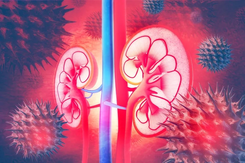 常見(jiàn)問(wèn)題解答:IgA腎病的進(jìn)展 常見(jiàn)問(wèn)題解答:IgA腎病的進(jìn)展