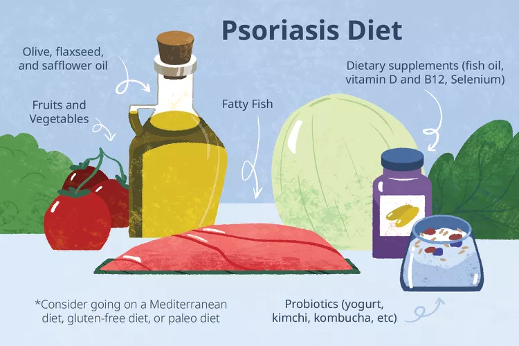 適合銀屑病患者吃的5種食物，你知道幾種？