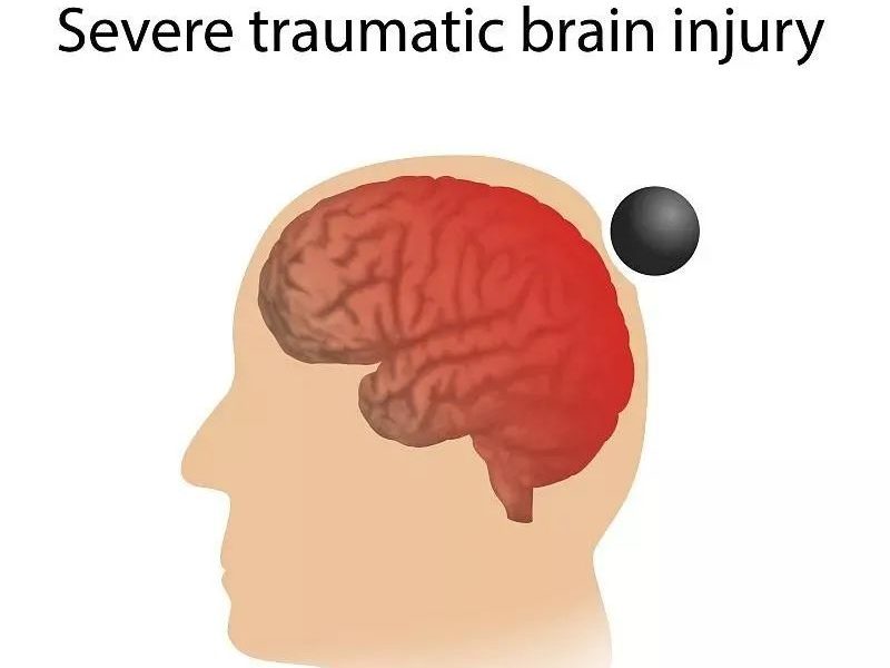 干細胞移植為缺血性腦損傷的治愈提供無(wú)限可能