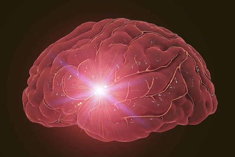 神經(jīng)干細胞移植治療缺血性卒中的作用