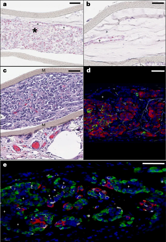 圖3：植入后第6個(gè)月時(shí)裝置封裝的人類(lèi)干細胞衍生植入物的成分。