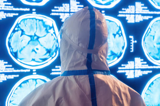 間充質(zhì)干細胞三大作用機制用于治療中樞神經(jīng)系統疾病