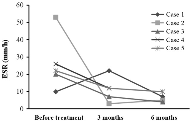 圖3:每位患者在治療前后的ESR。3例患者血沉明顯下降