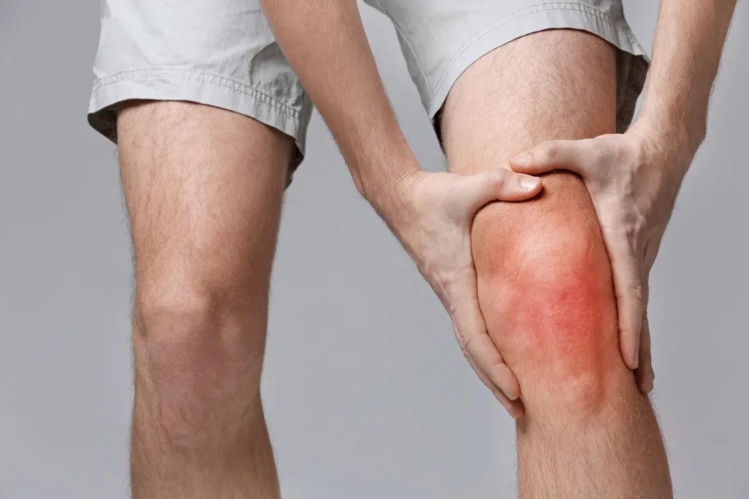 膝骨關(guān)節炎