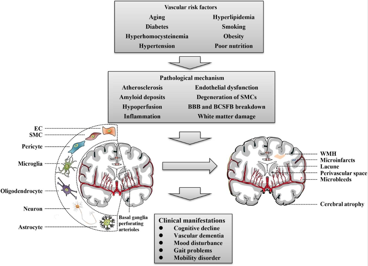 圖1:腦小血管病概述 圖1:腦小血管病概述