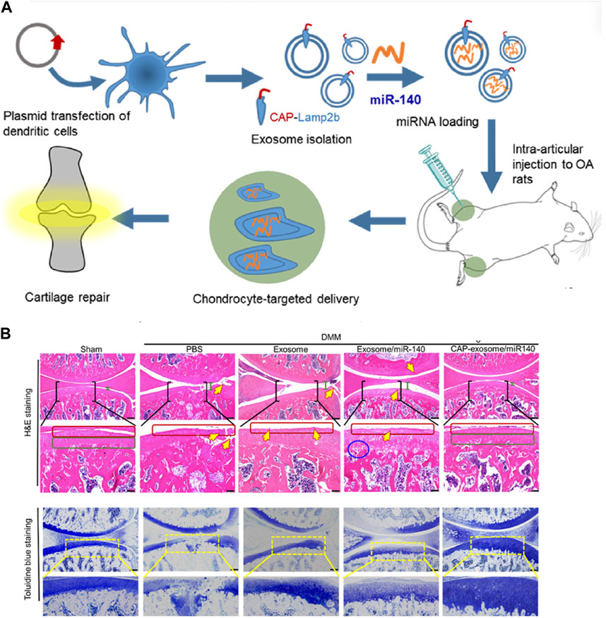 圖3：MSC-Exos藥物輸送用于OA治療的代表性研究。