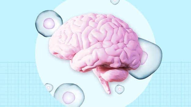 早期數據表明干細胞療法可以“重置帕金森病的時(shí)鐘”