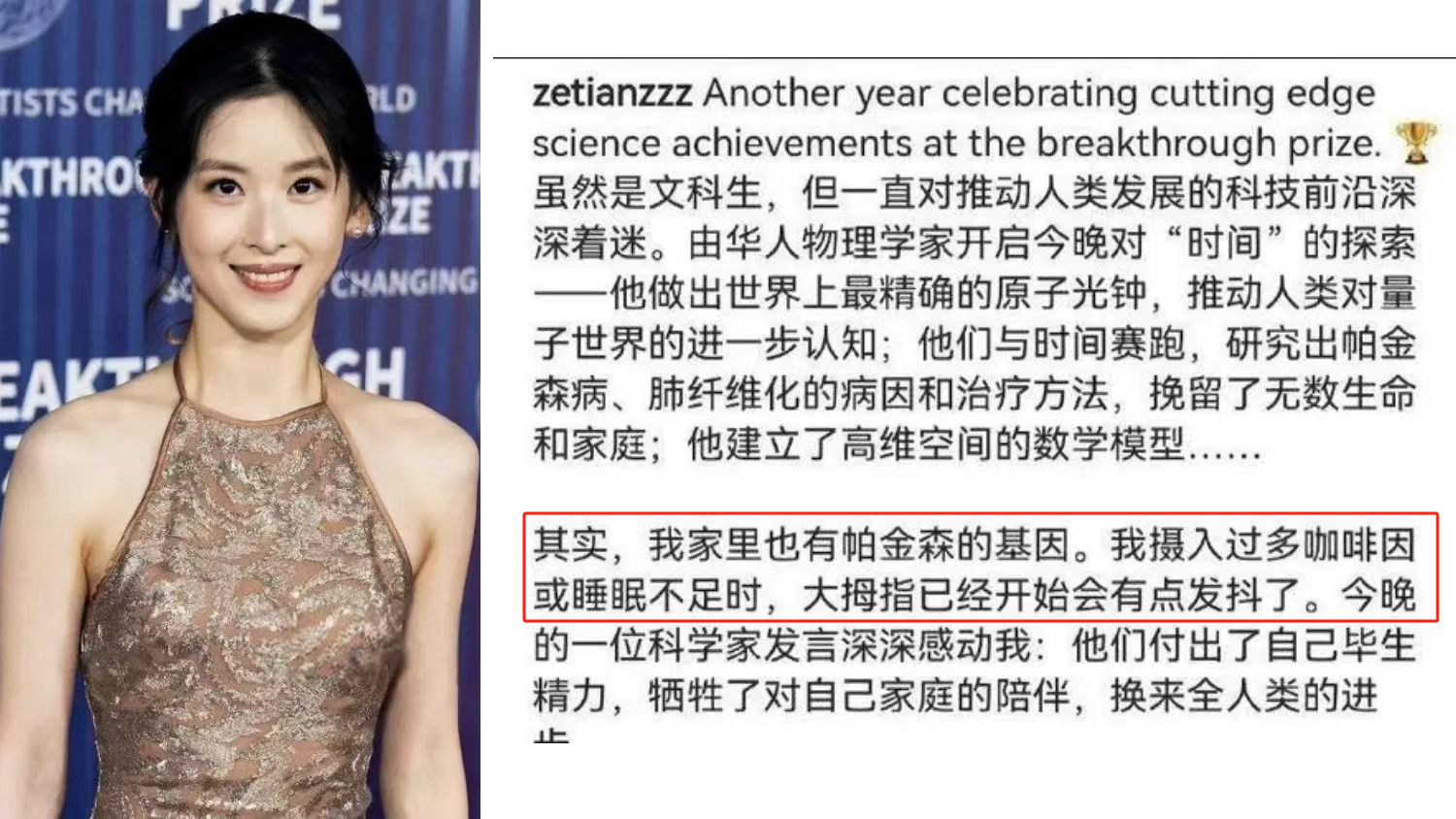 章澤天自曝有帕金森病家族史，干細胞療法讓年輕人不再懼“帕”