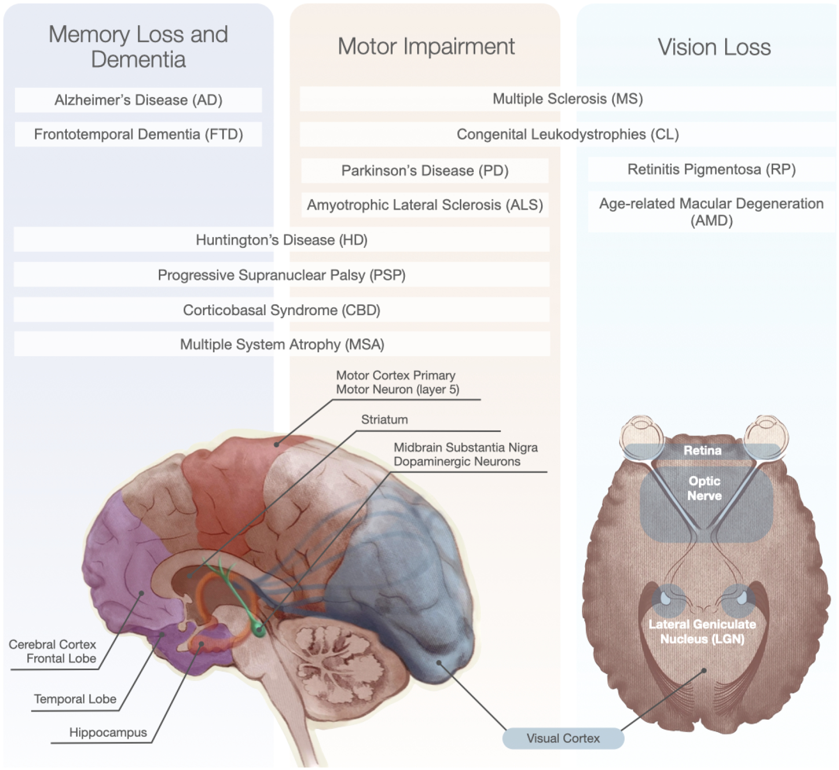 圖1：神經(jīng)退行性疾病和受影響的大腦區域的主要功能影響。