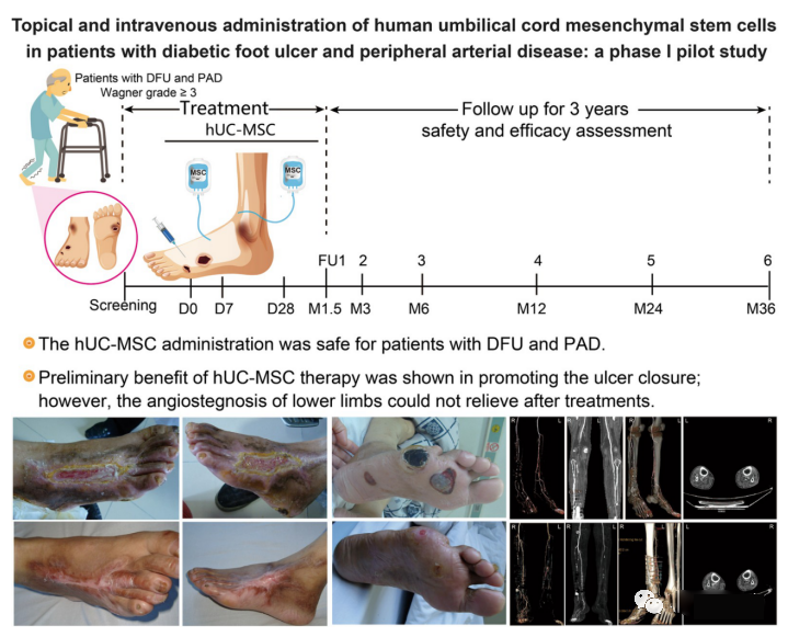 探索干細胞對糖尿病足愈合的療效和機制。
