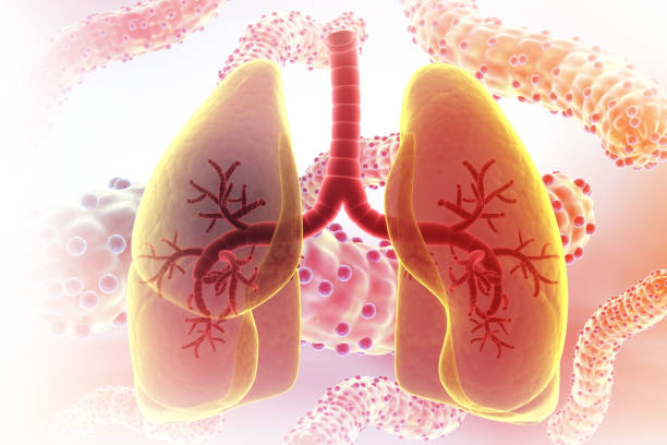 獲得國家藥監局批準！廣州醫科大學(xué)附屬第一醫院正在開(kāi)展人臍帶源間充質(zhì)干細胞注射液治療IPF臨床研究
