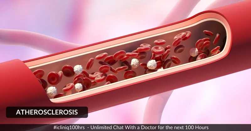 動(dòng)脈粥樣硬化的體征和癥狀是什么？治療方案有哪些？