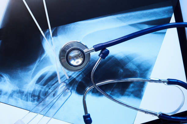 干細胞治療在風(fēng)濕病中的作用 干細胞治療在風(fēng)濕病中的作用