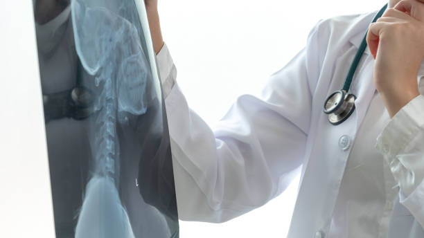 4種可行的治療強直性脊柱炎發(fā)方法，你都了解嗎？