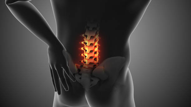 干細胞治療強直性脊柱炎的臨床案例有哪些?