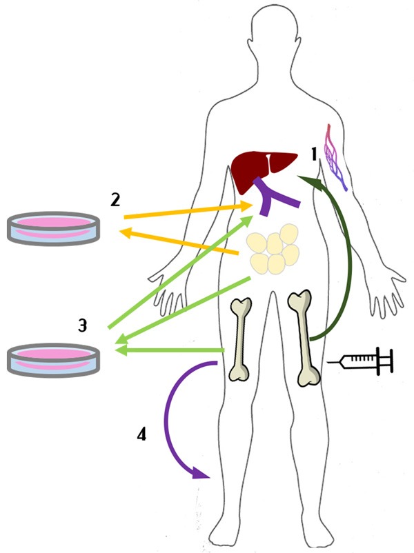 圖1：間充質(zhì)干細胞治療1型糖尿病方法示意圖。