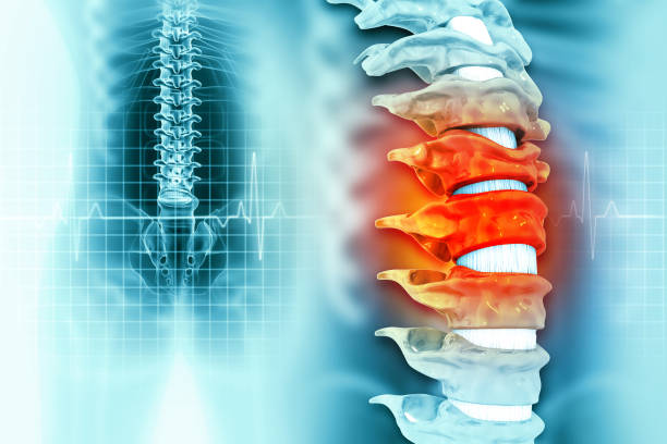 脊髓損傷的癥狀和原因是什么？及其治療方法