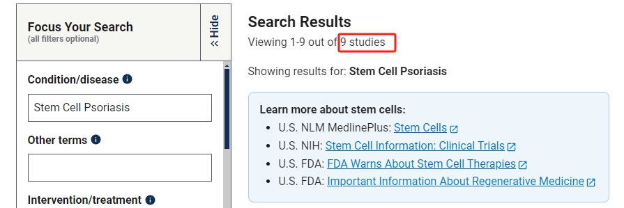 干細胞治療銀屑病的臨床研究進(jìn)展 干細胞治療銀屑病的臨床研究進(jìn)展