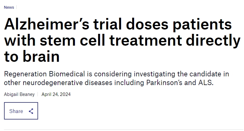 阿爾茨海默氏癥試驗將干細胞直接注入患者大腦