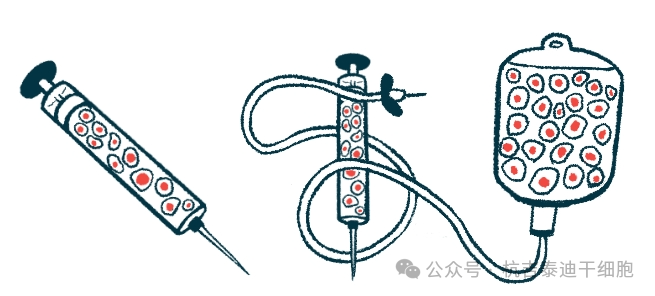 帕金森今日新聞：研究表明，低劑量TED-A9細胞療法可緩解帕金森病的運動(dòng)癥狀