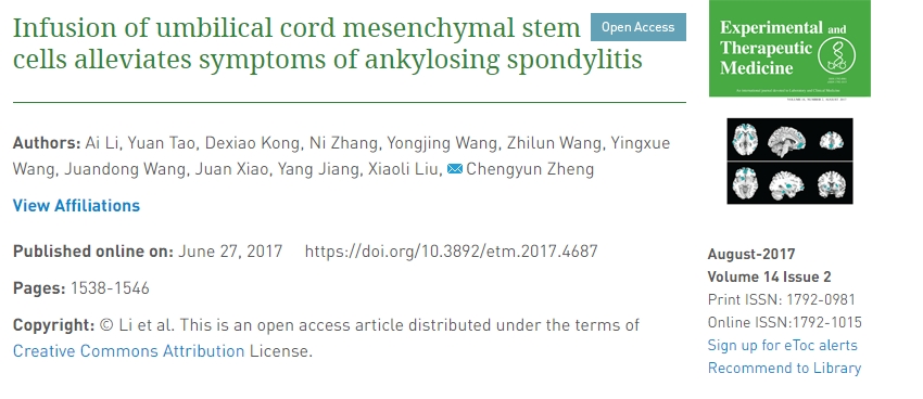 輸注臍帶間充質(zhì)干細胞可緩解強直性脊柱炎癥狀