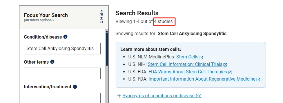 干細胞治療強直性脊柱炎臨床研究項目有4項